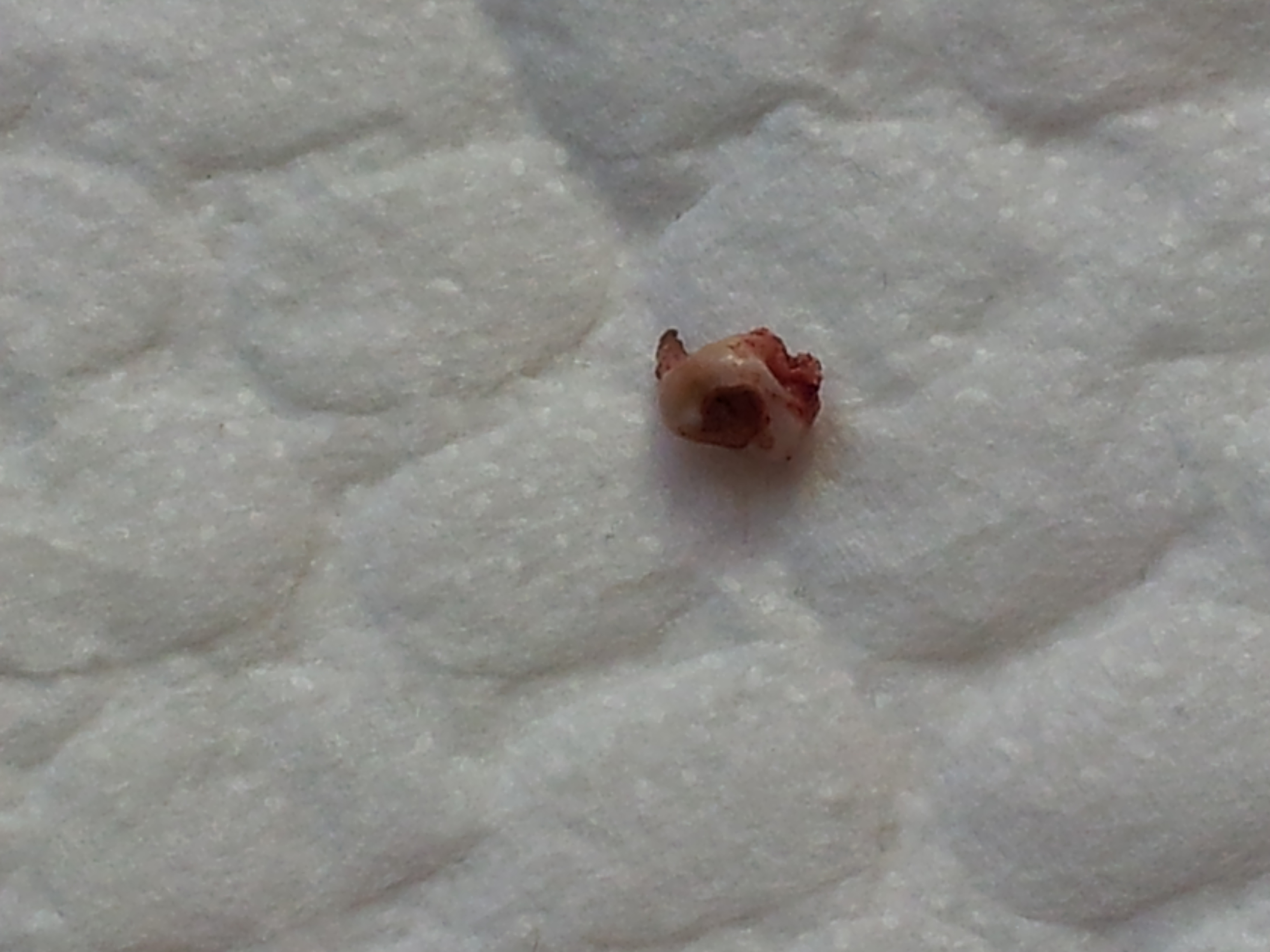 제나(꼬미)의 스케일링 이야기...